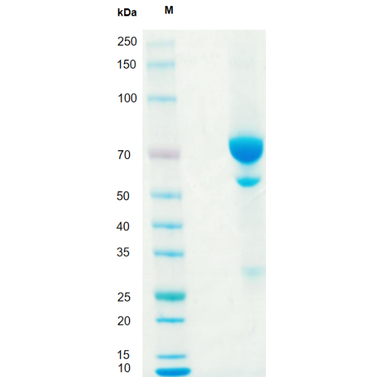 Anti-Human CD52 mAb Anti-Human CD52 mAb