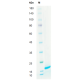 Recombinant Human PDGF-BB Protein